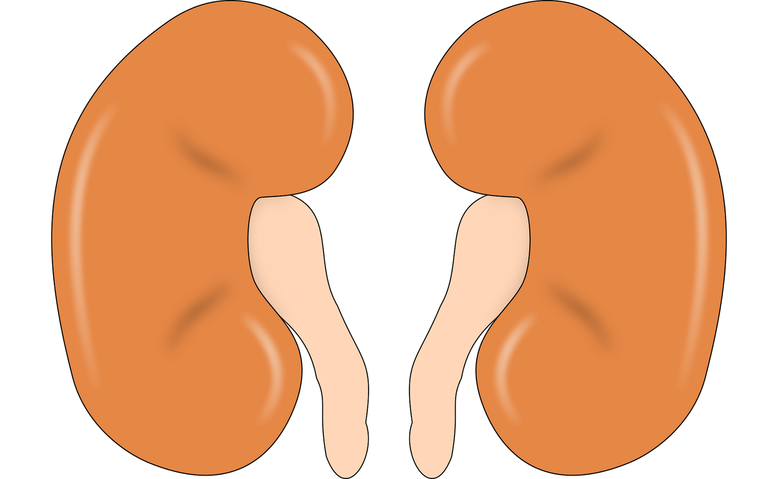 Which  technology is used in kidney dialysis in 2026?
